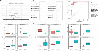 Comprehensive Analysis of a tRNA-Derived Small RNA in Colorectal Cancer